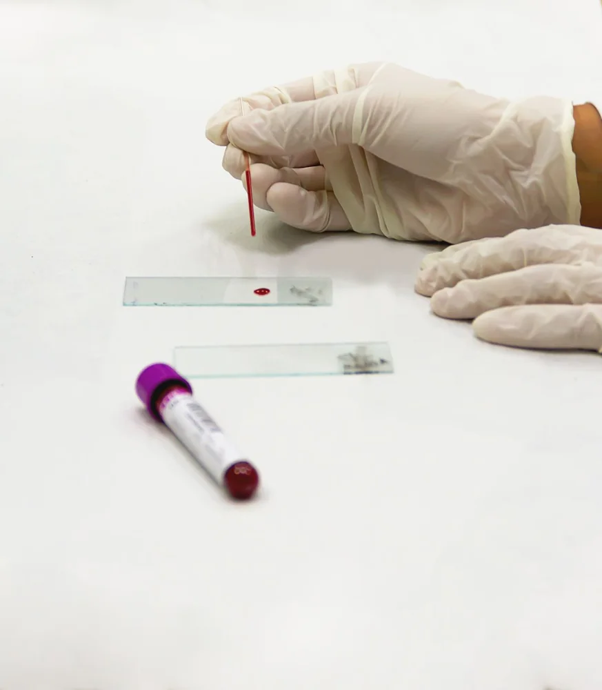 Laboratory blood sample analysis